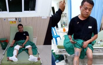 Aktivis Disiram Air Keras di Bangka Selatan, Korban Sebut Dua Pengendara Motor