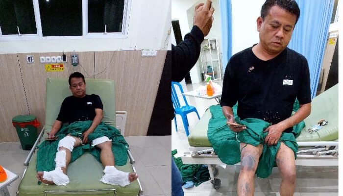 Aktivis Disiram Air Keras di Bangka Selatan, Korban Sebut Dua Pengendara Motor